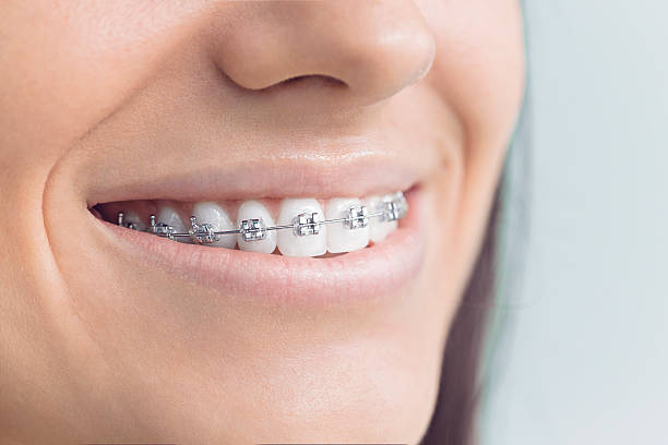 Best Dentures (Full and Partial)  in Port Salerno, FL